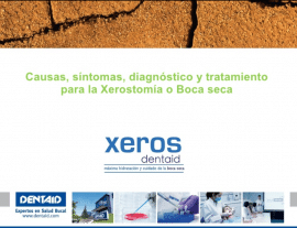Causas, síntomas y tratamiento para la xerostomía